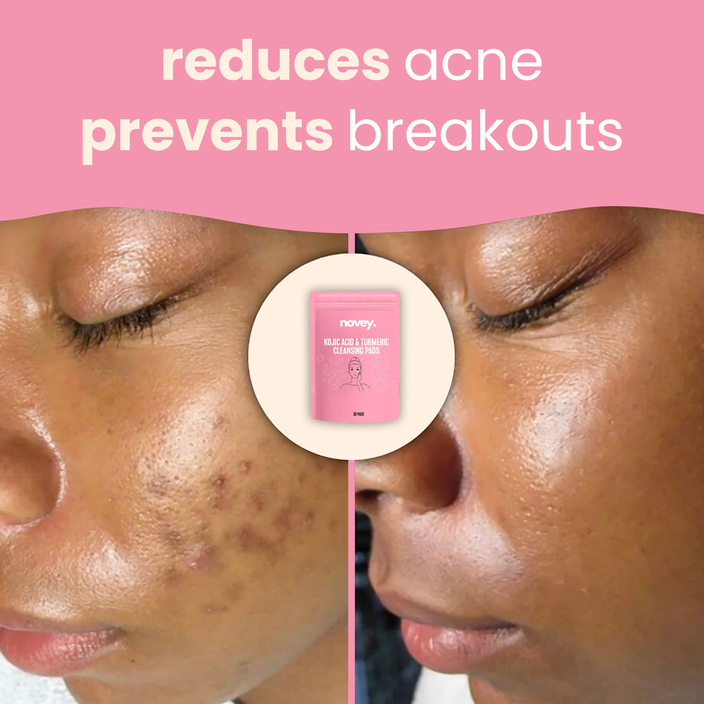 brightening turmeric & kojic acid pads