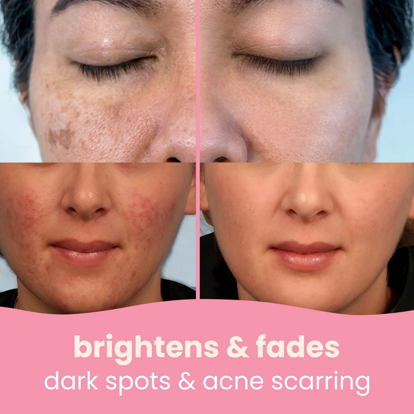 brightening turmeric & kojic acid pads